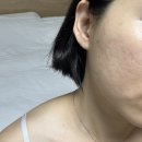 김주희 피부관리