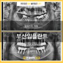 소명치과의원 | 부산임플란트, 전체적인 상황을 고려하여