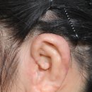 비아이오성형외과의원 이미지