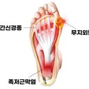 발 통증 유발하는 3대 질환 대처법 이미지