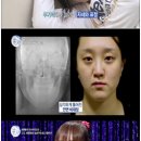 렛미인