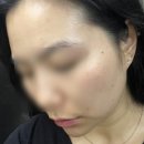 허브라인 | [방학동/에스테틱] 내돈내산_허브스킨케어_도봉구 피부관리실 리프팅 V라인관리 피부관리 솔직후기!