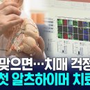 차세대 알츠하이머 치매 백신치료제 국내 최초 개발 / KNN 뉴스 이미지