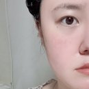 피부과 시술후 관리템 청담동 피쓰 재생크림 내돈내산 후기