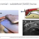 근골격계 Shoulder sono자료1 이미지