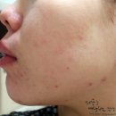 대종의료기(주) | 올리브영팩 23years old CXDX 더마에어톡스 탄산팩 후기!