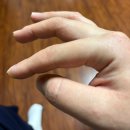 서울성모병원 | 임신 24주-26주 임산부소양증 크림추천후기 서울성모병원 피부과 광선치료