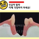 프레임치과기공소 네이버블로그