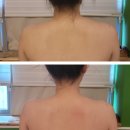 펜타힐즈로R | 휠로스 in 라피유 후기 : 경산피부관리샵 상체 관리 / 목어깨허리 통증관리 척추교정