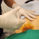 임학한의원 | 임학역한의원, 스테로이드는 더이상 X! 통증치료의 새로운 패러다임