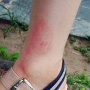 홍상선한의원 이미지