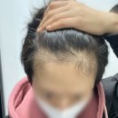 정연초 | [유방암일기72] 항호르몬제 부작용 9개월 차 | 페마라정 탈모·관절통·방사선 후유증 후기