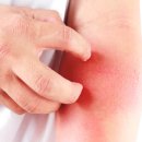 더힐피부과의원 이미지