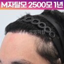 헤어라인 이미지