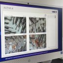 세정프라자 | 구월동 두피관리 모바이오 인천구월본점 지루성두피·각질 확실히 잡은 후기