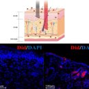 드비취이 이미지
