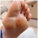 정자역발각질 뽀송하게 관리해주는 &#34;오로지푸스앤네일&#34;