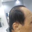 해운대독일보청기 이미지