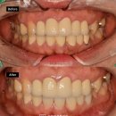 훈치과기공소 이미지