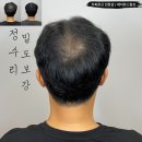 레이븐스칼프