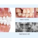 라임나무 이미지
