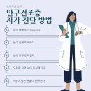 누네조은안과
