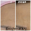 봉곡동257 | 주름.입가.팔자주름.얼굴볼륨.얼굴빵빵.리프팅미백.모공.피부결.피부보약/봉곡동피부관리행사.에스테틱추천