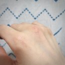 스킨바나나 | 온 가족 나이트 루틴 된 스킨푸드 바나나 PDRN 실키패드 리얼 후기~!