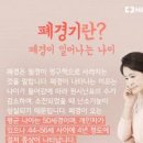 폐경 초기 전조 폐경기 나이 시기 검사 조기폐경 원인 종합적으로 정리함 이미지