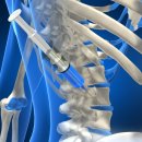 바로척척신경외과의원 이미지