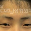 코지성형외과 네이버블로그