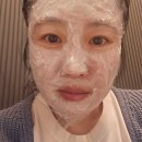 대구수성구피부과 리쥬엘 흑자제거, 주근깨 제거 엑셀브이 리팟레이저 자세한 후기