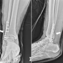 수원-0780 이미지