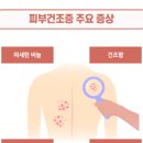 질건조증 증상 및 원인과 치료 : 효과적인 예방법은 이것? 이미지