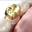 크라운사거리 이미지