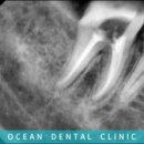 오션기공소 이미지