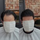 리프트이마산업 | 의정부에서 엠자이마 와 정수리 탈모 때문에 탈모펌 하러 오신 고객님 시술 리뷰와 후기입니다