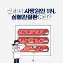 돌연사의 주범 '협심증'의 이해 이미지