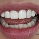 건치치과기공소 이미지