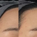 현촌4길 | 평택 피부관리샵 용이동 "미유뷰티크" 스킨플래닝 후기