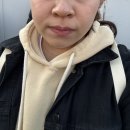 조아간판 | 평택역 근처 피부과 노란간판 인모드 후기