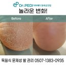 닥터페디(동래온천점) | 건조한 계절, 자신 있게 발을 드러내세요 동래발각질 관리 닥터페디 동래온천점에서