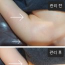 청담피부관리샾