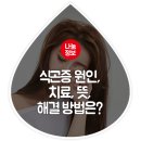 식곤증 원인, 치료, 뜻, 해결 방법은? 이미지