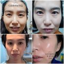 보석인셀덤 네이버블로그