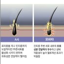 만상공구 | 모바타 프리미엄 공동구매 예고! 볼륨 + 탈모 고민을 한번에 해결해주는 샴푸 드디어 찾았다ㅠㅠㅠ