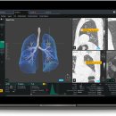 코어소프트 이미지