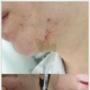 새결 에스테틱 | 새결에스테틱 이용후기와 제품 추천