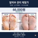 3843 | 평내호평 문제성발톱 무좀 내성발톱 케어 잘 하는 곳 푸스인솔 후기