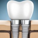 안희용치과의원 이미지